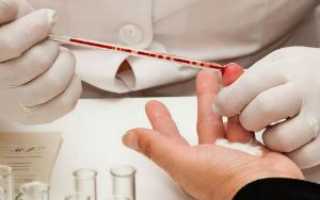 Расшифровка анализа крови из пальца у женщин