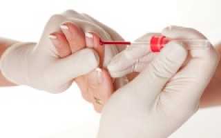 Расшифровка анализа крови с пальца взрослого