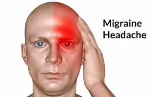 Как избавиться от головной боли при мигрени