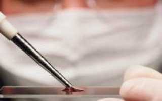 Расшифровка анализа на свертываемость крови