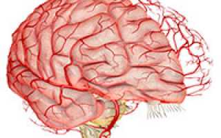 Как лечить сосуды головного мозга в домашних