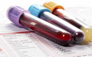Расшифровка анализа крови биохимия у детей