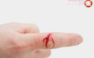 Как быстро остановить кровь при порезе пальца