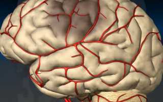 Как вылечить сужение сосудов головного мозга