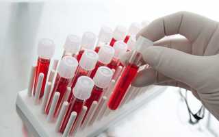 Расшифровка иммуноферментного анализа крови