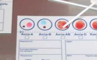 Как определяется группа крови и резус фактор