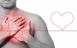 Инфаркт миокарда осложнения острого периода