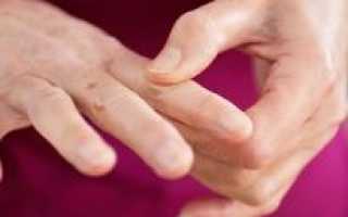 Как восстановить чувствительность пальцев рук