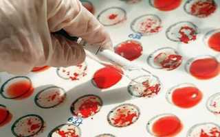 Как определить кровь ребенка по крови родителей