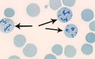 Ретикулоциты как обозначаются в анализе крови