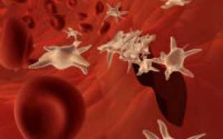 Резкое снижение тромбоцитов в крови причины