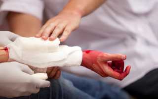 Как остановить венозное кровотечение на руке