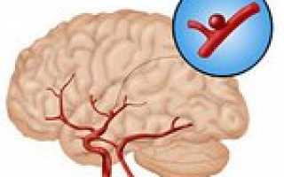 Профилактика аневризмы сосудов головного мозга