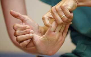 Как восстановить правую руку после инсульта