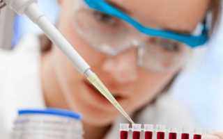 Расшифровка анализа крови биохимия обозначения